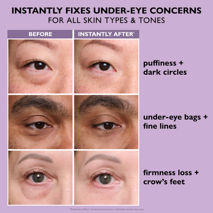 Instant FirmXBOTOX Eye Temporary Eye Tightener Easy-Wear Formula ⏰Limited Time 80% Off - Last 30 Minutes ⏰