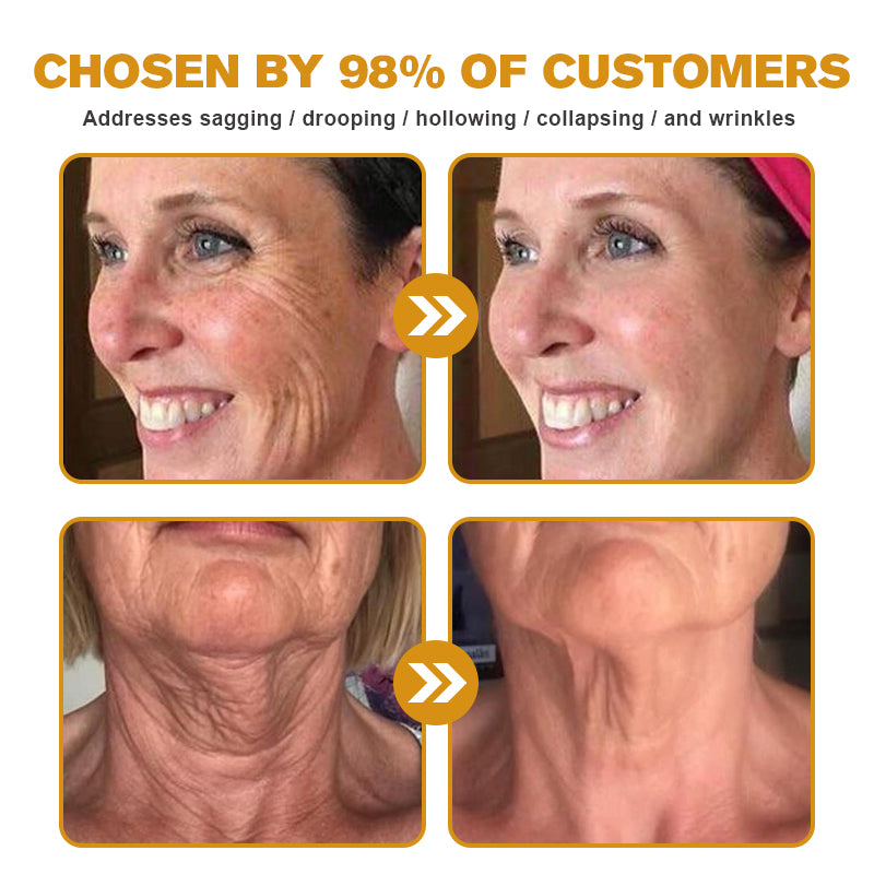 Instant FirmXBOTOX Eye Temporary Eye Tightener Easy-Wear Formula ⏰Limited Time 80% Off - Last 30 Minutes ⏰