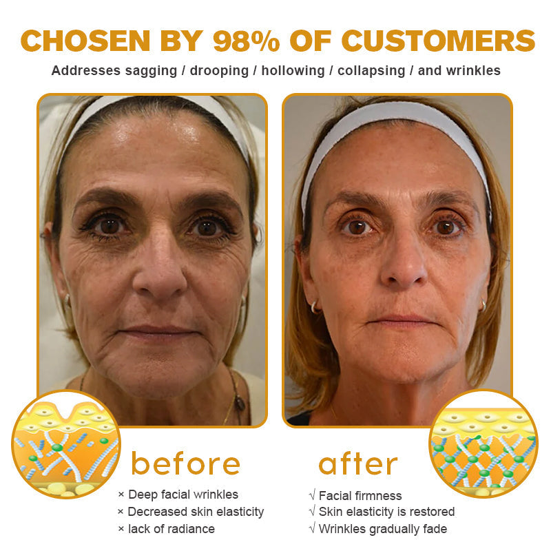 Instant FirmXBOTOX Eye Temporary Eye Tightener Easy-Wear Formula ⏰Limited Time 80% Off - Last 30 Minutes ⏰