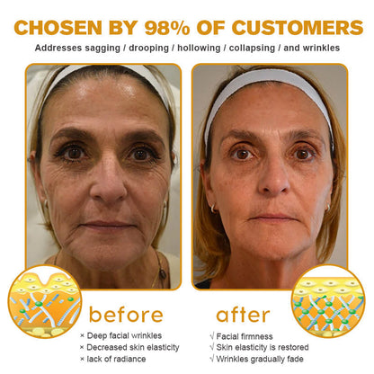 Instant FirmXBOTOX Eye Temporary Eye Tightener Easy-Wear Formula ⏰Limited Time 80% Off - Last 30 Minutes ⏰